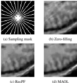 Fig. 3 : Sampling mask and reconstruction results for (b) in- in-verse FFT after zero-filling missing Fourier coefficients, (c) the RecPF algorithm, and (d) our proposed separable  ap-proach MAOL.