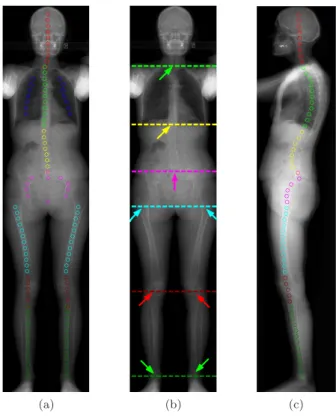 Figure 3: According to the manually annotated landmarks on the frontal view acquisition (a), 6 horizontal lines (b) can be identified to initialize the method (from top to bottom): T1 (green); T12 (yellow); L5 (magenta); proximal femur (cyan); knees (red);