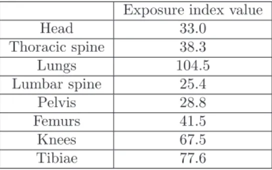 Table 1: Exposure index measurements in anatomical regions of a full-body frontal view exam acquired with the EOS system.