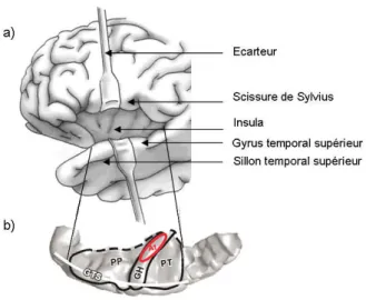 Figure 8 :  a) Vue  latérale  du  cortex  cérébral  gauche  situant  le  sillon  temporal  supérieur (STS), le gyrus temporal supérieur (GTS), la scissure de Sylvius et laissant  apparaître  l’insula  à  l’aide  des  écarteurs  (schéma  adapté  de  Purves 