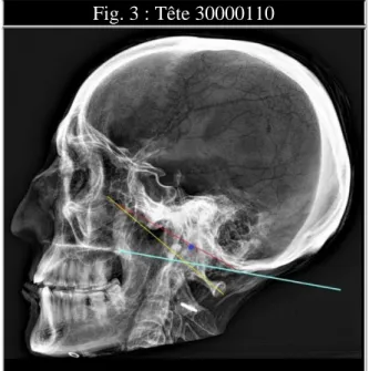 Fig. 3 : Tête 30000110 