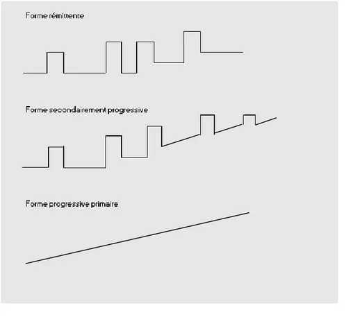Figure 2. Les formes cliniques de SEP (selon Lublin et Reingold, 1996) 