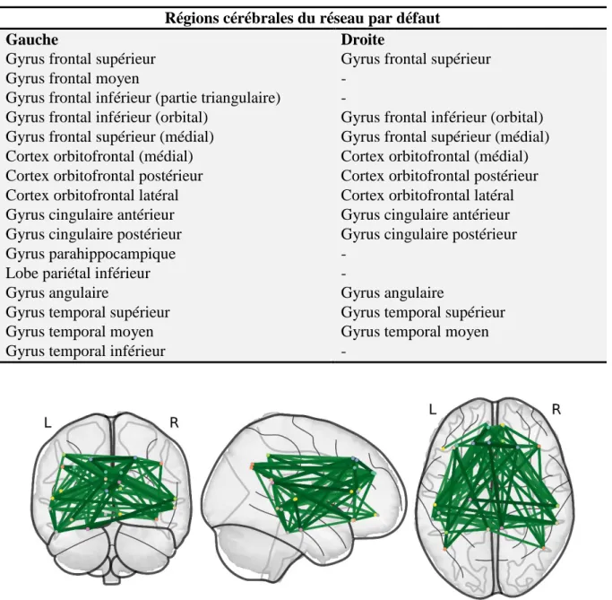 Figure 7. Illustration du réseau par défaut reconstitué par PyNets pour un patient  présentant une schizophrénie