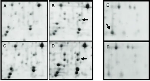 Figure 4. Regions of the 2D gels showing differential accumulation of the HSP26 protein  (A to D) and of chloroplast carbonic anhydrase (E and F) are presented