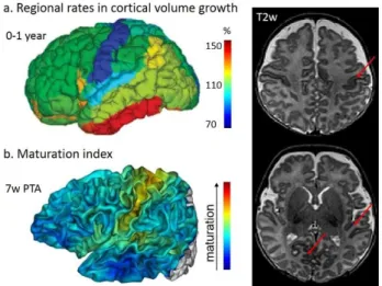 Figure 3: Asynchronous development of brain regions 