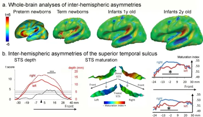 Figure 4: Inter-hemispheric asymmetries in cortical development 