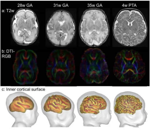 Figure 1: Structural imaging of the developing brain. 