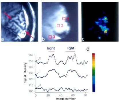 Figure 1.9: Illustration of the use of BOLD contrast for functional imaging. (a) Sagittal slice of an anatomical image, showing the occipital cortex