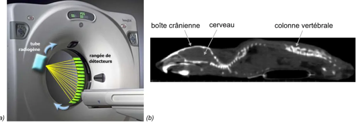 Figure 1.9  Imagerie par TomoDensitoMétrie : (a) Schéma de principe du fonctionnement d'un tomodensitomètre où la source de rayonnement X (tube radiogène) ainsi que les détecteurs tournent autour du sujet (D'après http: // www