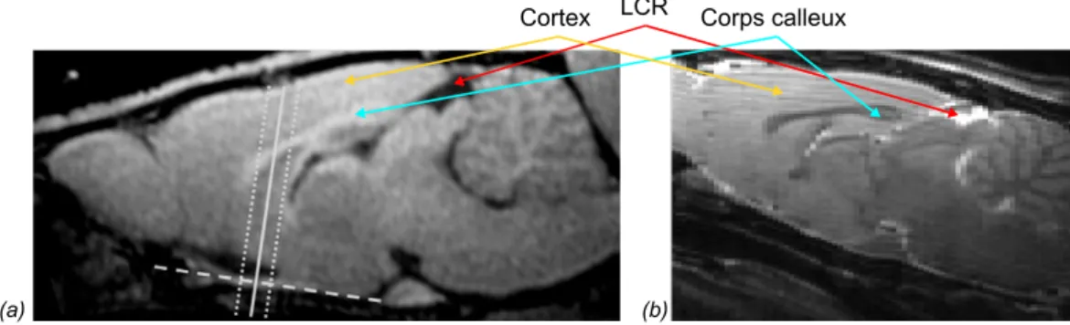 Figure 1.10  (a) Vue sagittale d'une IRM de rat pondérée en T1 (d'après Boretius et al