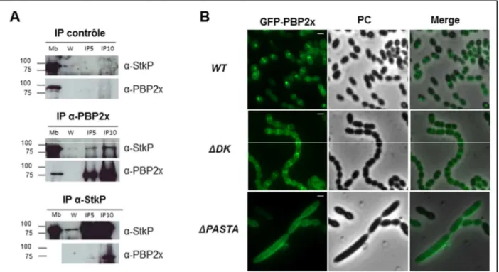 Figure 9. Le rôle de StkP dans la division de S. pneumoniae implique une interaction avec PBP2x