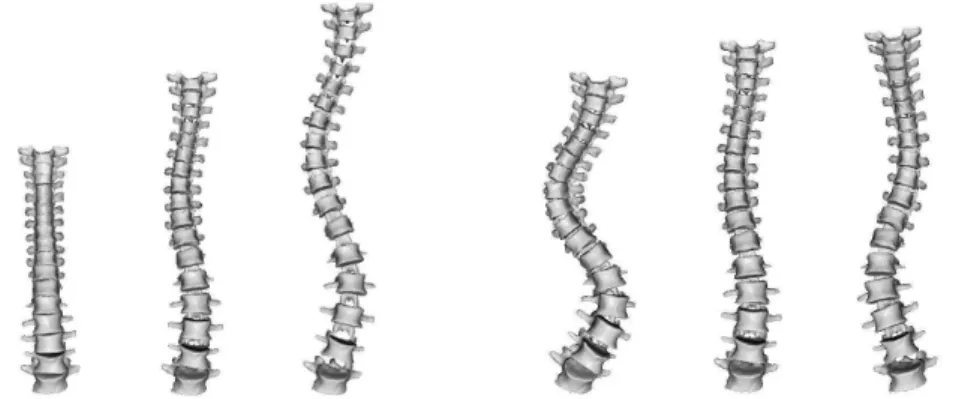FIGURE 2. First (left) and second (right) modes of variation of the statistical spine model depicted at -3, 0 (mean) and 3 times its standard deviation