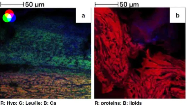 Fig. 30. High spatial resolution ion images of the skin cross section. (5a): Three color overlay be- be-tween ion images (HYP: hydroxyproline fragment in red (R), leucine or isoleucine fragment in  green  (G)  and  calcium  ion  in  blue  (B))