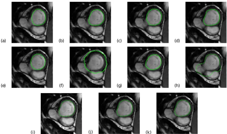 Fig. 1. Basal cine MRI slice at end-diastole with superimposed contours of the LV (green line) as obtained using the eight segmentation methods included in the study (M 1 to M 8 represented from (a) to (h) respectively) and using the three different combin