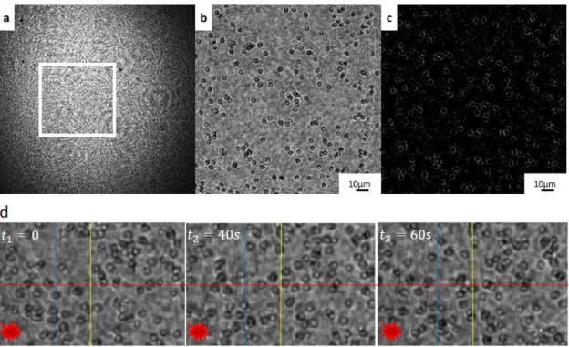 Fig. 3. 11  presents the hologram with its amplitude and phase reconstructions of living 