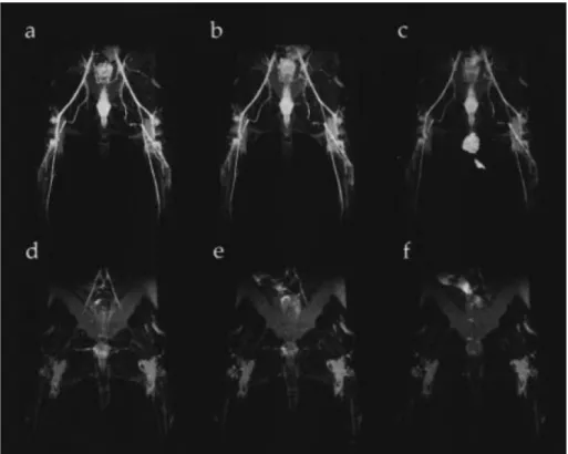 Figure  1.10  Images  IRM  d’arrière-trains  de  lapin  après  injection  de  MS-325  (a-c,  0,025mmol.kg -1 ),  ou  de  Gd-DTPA  (d-f,  0.1mmol.kg -1 )