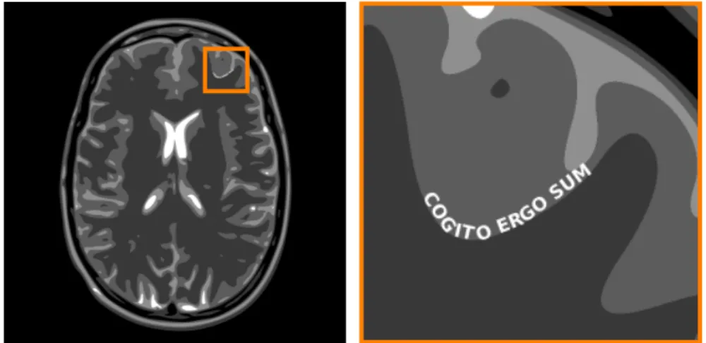 Figure 7: Axial slice of the brain phantom used in our 2, 048 × 2, 048 im- im-ages (left) with a magnification on the left frontal area where the text has been superimposed (right).