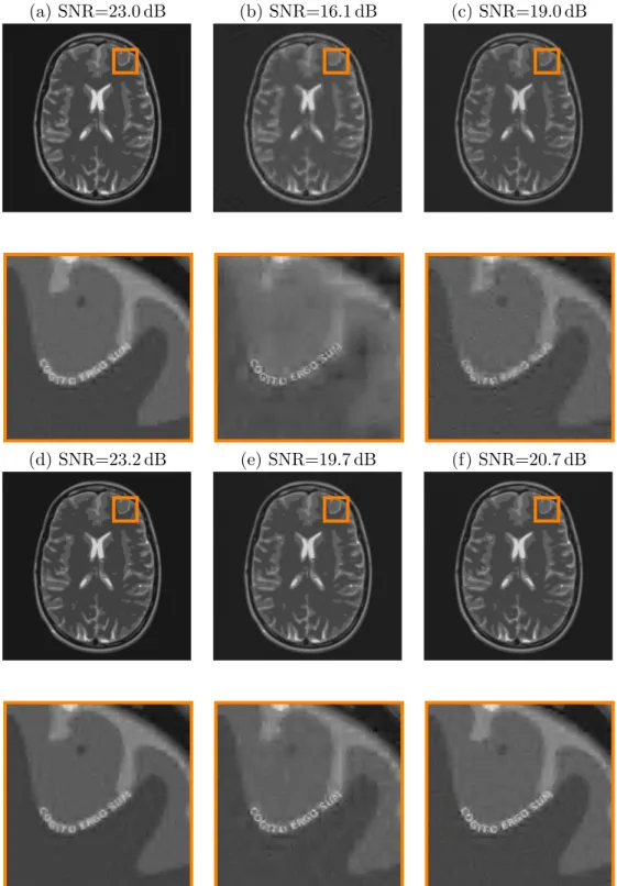 Figure 10: Very high resolution reconstructions using 100, 000 samples (2.4% of the number of pixels) and different sampling schemes