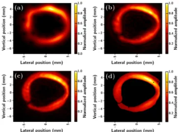 Fig. 2. Phase residual after removing 26θ (left). 2D integral of the absolute phase residual after removing lθ to the datas, normalized by the value obtained for l= 1 (right)