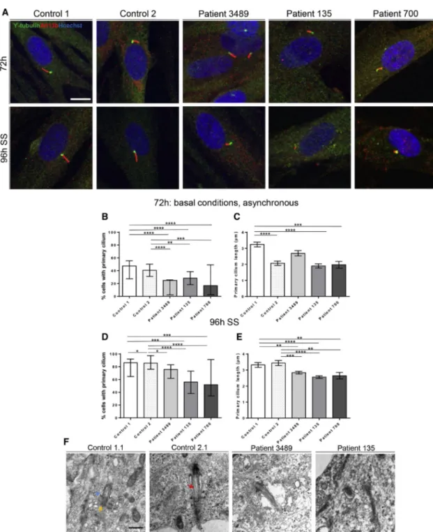 Figure 4. Primary Cilium Formation Is Perturbed in EML1 and RPGRIP1L Patient Fibroblasts and Cortical Progenitors Differentiated from EML1 Patient-Derived iPSCs