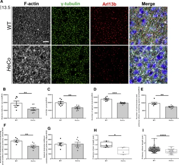 Figure 1. Centrosomes, Primary Cilia, and Apical Endfeet Are Decreased at the HeCo Ventricular Surface