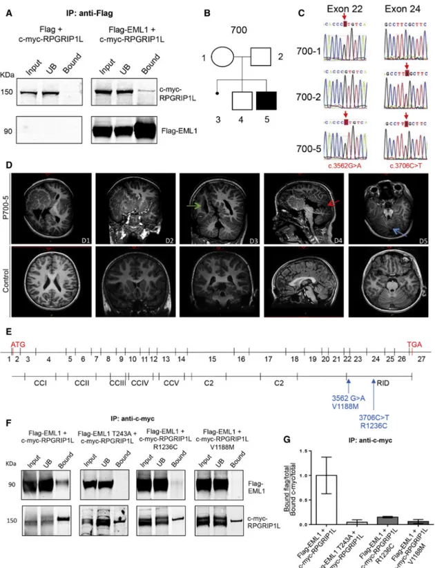 Figure 3. EML1 Interacts with RPGRIP1L, in which Mutations Were Identified in a Heterotopia Patient