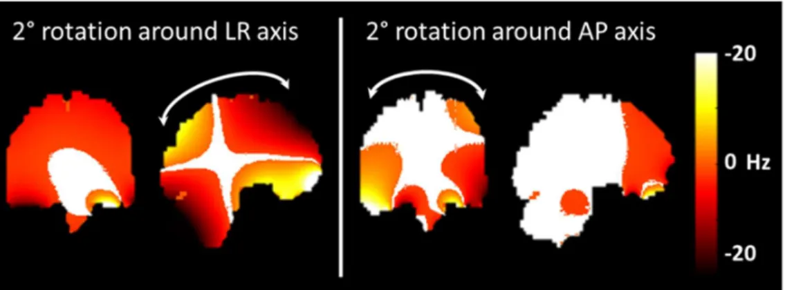 Figure  1:  Frequency  shift  induced  by  head  rotations.  Frequency  shift  induced  by  head  rotations of 2° around the Left-Right (LR) and Anteroposterior (AP) axis on the coronal and  sagittal planes