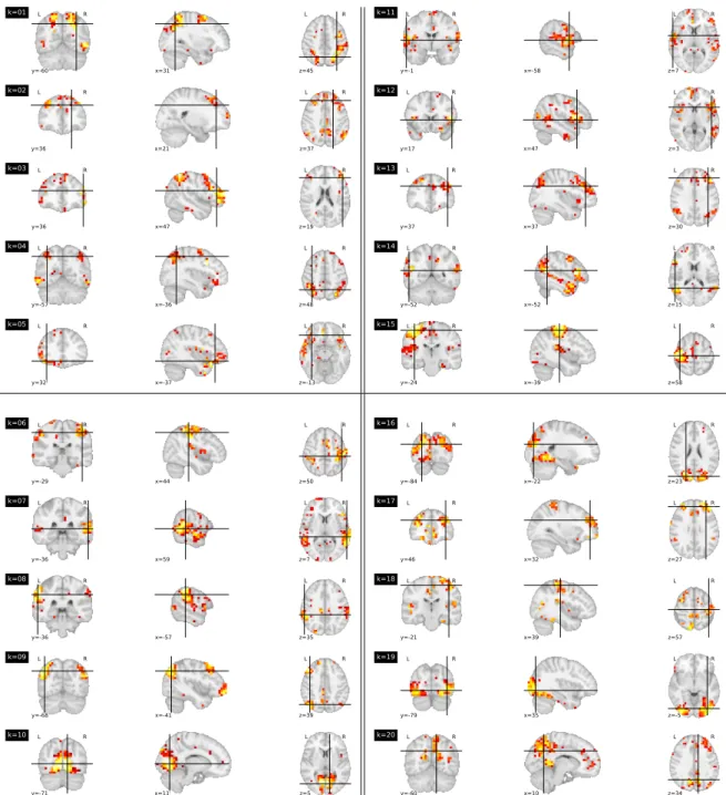 Figure 6: Spatial decomposition of rs-fMRI data for K = 20. From top to bottom and left to right, the twenty labeled spatial maps are shown using the three orthogonal views (coronal on the left, sagittal in the middle and axial on the right)