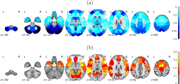 Figure 11: Statistical analysis of the haemodynamic differences between middle-age (MA) and elderly (E) subjects
