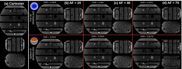 Fig. S2: Comparison of retrospective results for globally optimized 3D SPARKLING (top row) and SpSOS (bottom row) for varying acceleration factors (from left to right, AF=20 (b), 40 (c) and 70 (d)) on the NIST phantom