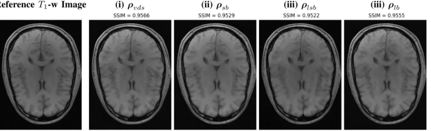 Fig. 3. NC-PDNet-based image reconstruction for retrospective T 1-w imaging with slice 6 in file brain AXT1 201 6002725.h5 from validation data in fastMRI dataset for different target sampling densities.