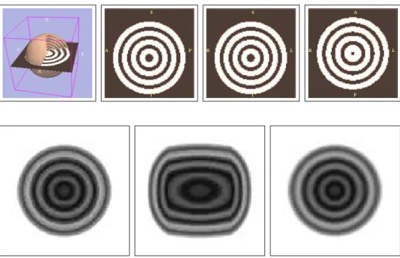 Fig. 7 – Premi`ere ligne : visualisation qualitative du fantˆome statique f : vue 3D (gauche), coupe `a Z = 1/100 (centre gauche), coupe `a Y = 1/100 (centre droit), coupe `a X = 1/100 (droite)