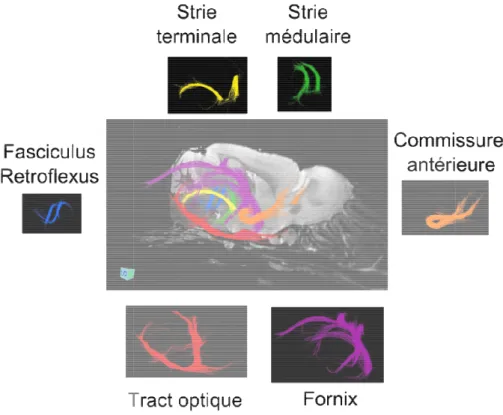 Figure 10. Tractographie d’un cerveau de souris. Différentes structures de matière blanche sont sélectionnées en  délimitant des régions d’intérêts sur les images haute résolution 3D.