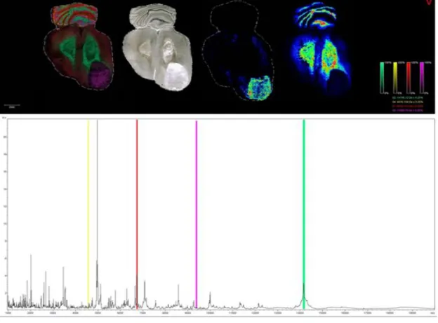 Figure 10 : Imagerie MALDI d’un encéphale de rat. 