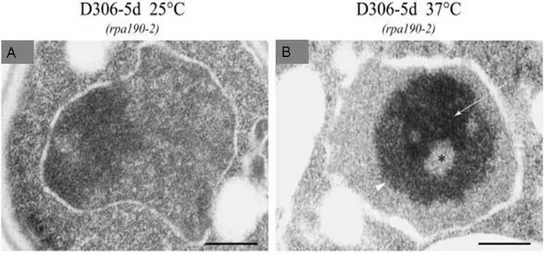 Figure 13 : Analyse en microscopie électronique de l’influence d’une mutation dans  Rpa190 (rpa190-2) dans la souche D306-5D