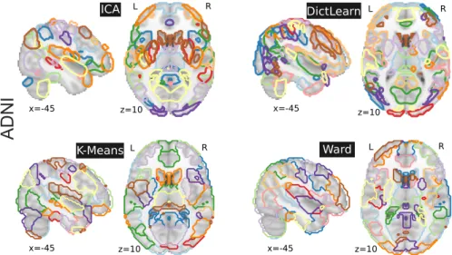 Figure 2.1: Brain regions extracted with ICA, DictLearn, KMeans, and Ward For ICA and dictionary learning, the dimensionality is of 80 and 60 resting-state networks – which are then broken up into more regions – yielding 150 regions, and 120 for KMeans and