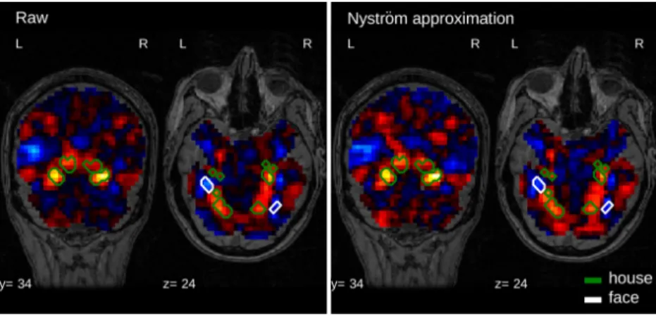 Figure 3.4: Approximation in the brain space: Weight maps (unthresholded) of a ℓ 2  -logistic regression, obtained for the discrimination of face and house on the Haxby dataset