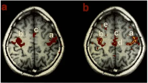 Figure  7  |  BOLD  correlation  in  the  motor  cortex  under  activation  and  at  rest