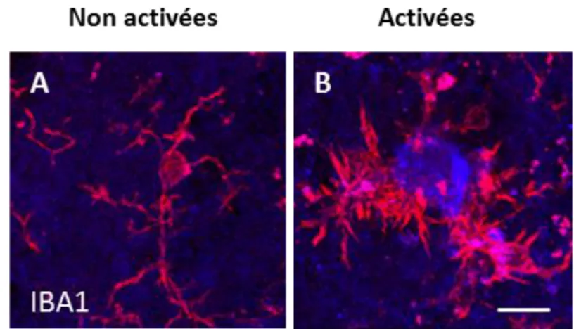 Figure 14 : Les changements morphologiques de la microglie reflètent son activation. 
