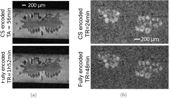 Figure V  Images de ganglions buccaux (résolution isotropique de 25 µm ) acquises avec un échantillonnage complet (bas) et un sous-échantillonnage CS de 50% (haut).