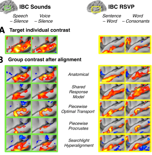FIG. 8. Comparison of alignment methods geometrical e↵ects. (A) Activation patterns for the Target subject (IBC sub-04) for two contrasts from the IBC Sounds task (Speech > Silence, Voice > Silence) and IBC RSVP task (Sentence >