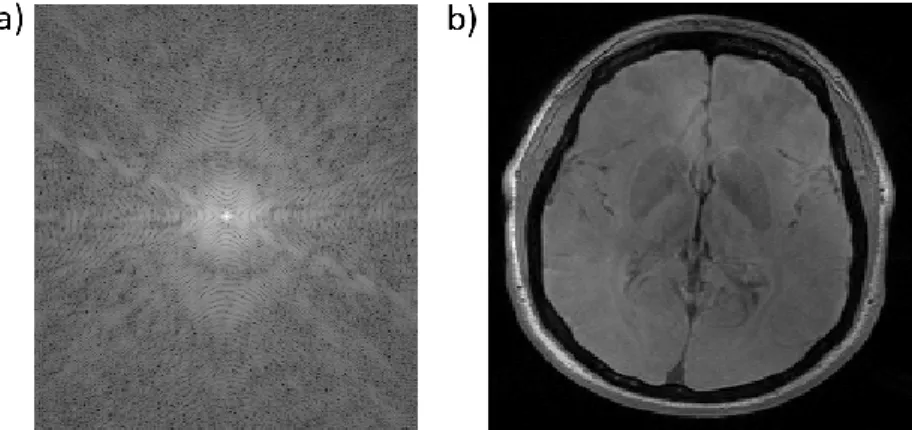 Figure 2.2 : Logarithm of the modulus of complex k-space NMR data (a) and the magnitude of the  associated reconstructed image through 2D discrete inverse Fourier transform (b) 