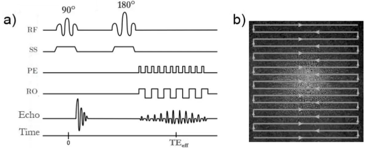 Figure  2.5:  a)  Spin-echo  EPI  sequence  scheme.  b) Illustration  of  an  EPI  k-space trajectory