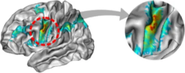 Fig. 4. The activity on the pre-central gyrus has also been projected on the neighbour- neighbour-ing gyrus (post-central gyrus).