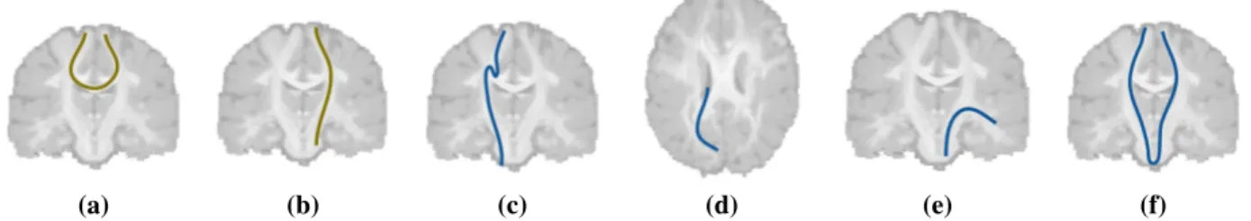 Figure 1: Schematic representation of “plausible” and “implausible” streamlines: (a) “plausible” streamlines belonging to the corpus callosum; (b) “plausible” streamlines belonging to the corticospinal tract; (c) “implausible” streamline containing a loop 