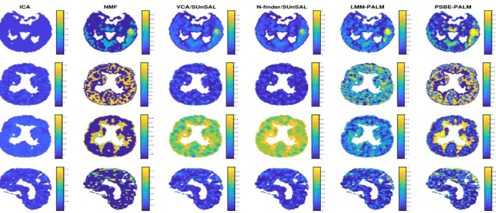 Fig. 8. Abundance maps of the real image, where the first 4 lines show a transaxial view while the last one shows a sagital view