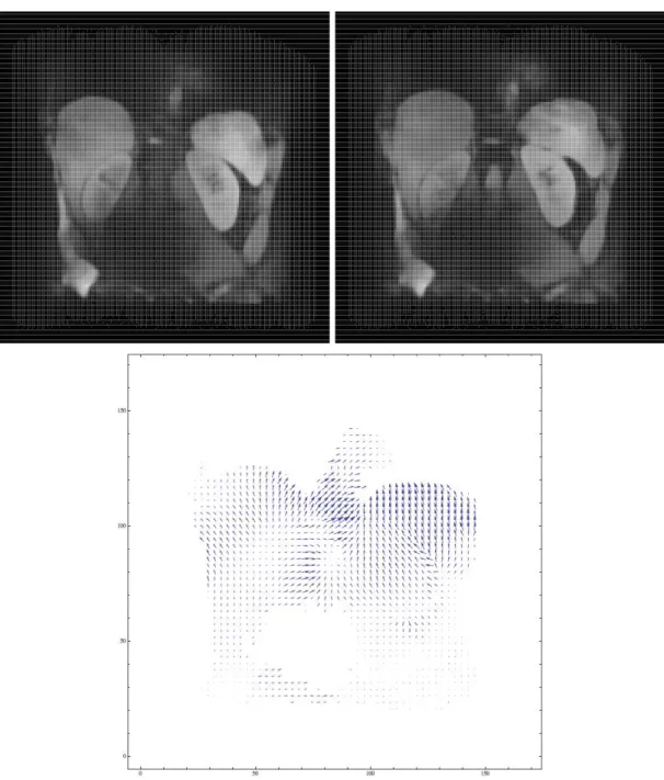 Figure 9: TC4. Top row: initial and final grey-scale densities. Bottom: optimal mapping.