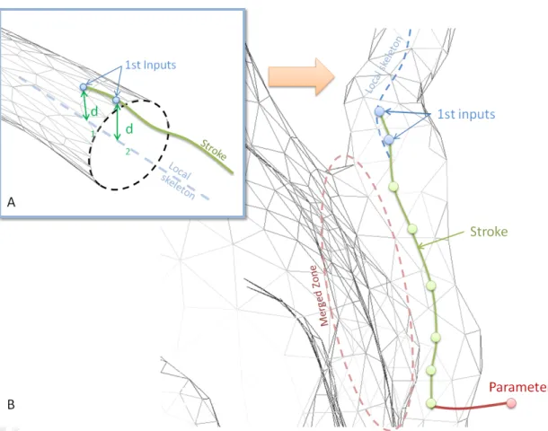 Figure 7: Application of the walking stick stroke algorithm on merged zone: the user begins his gesture on a vessel already tagged (picture A), and continues his gesture by drawing the path of the kissing vessel (picture B)