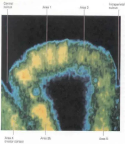 Figure 5: Columns from the primary somatosensory cortex shown by auto-radiography after 45 minutes of stroking a hand with a brush