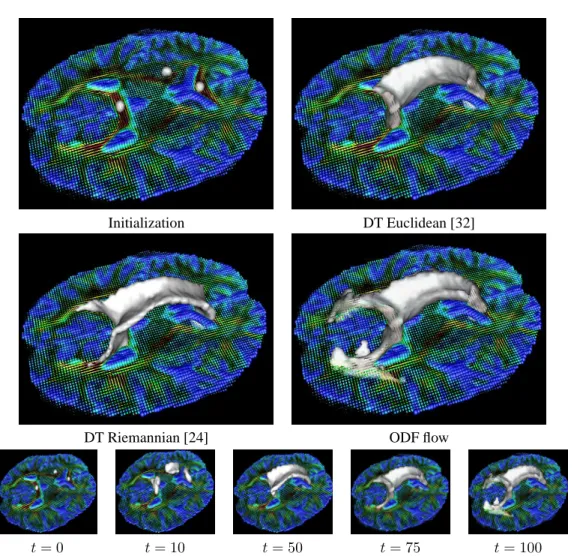 Figure 9: ODF flow segmentations can propagate through crossing regions and get a more accurate segmentation of the corpus callosum (CC)